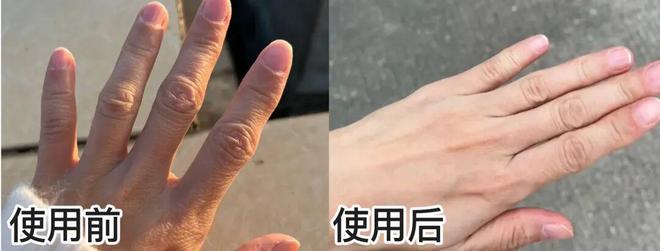 丑!后来发现是小丑竟然是我的手ag九游会登录一直以为是首饰太(图3) 丑!后来发现是小丑竟然是我的手ag九游会登录一直以为是首饰太(图3)
