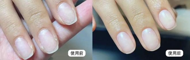 丑!后来发现是小丑竟然是我的手ag九游会登录一直以为是首饰太(图7) 丑!后来发现是小丑竟然是我的手ag九游会登录一直以为是首饰太(图7)