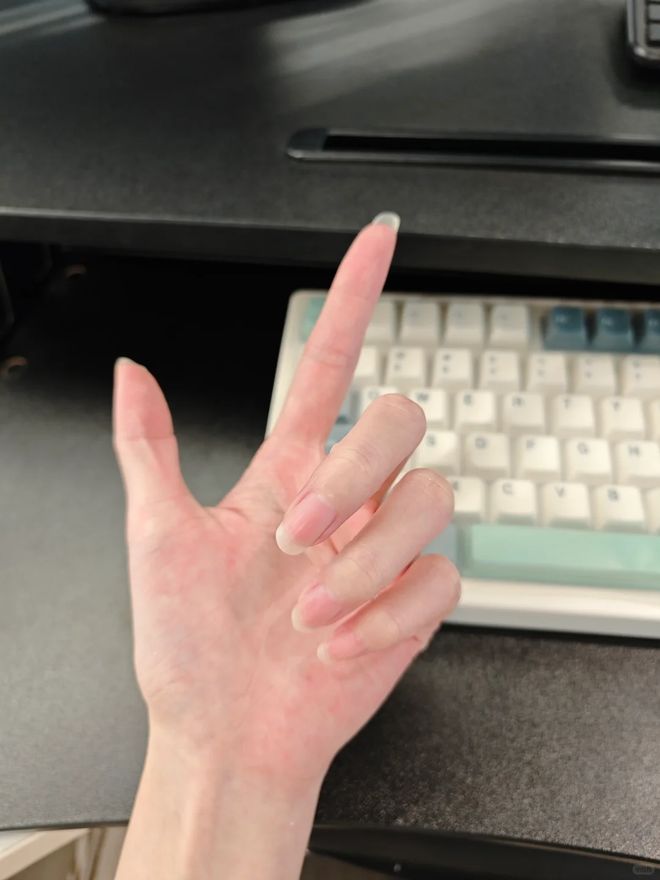 丑!后来发现是小丑竟然是我的手ag九游会登录一直以为是首饰太(图9) 丑!后来发现是小丑竟然是我的手ag九游会登录一直以为是首饰太(图9)