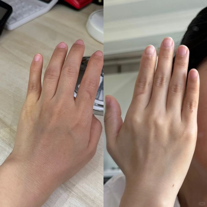 丑!后来发现是小丑竟然是我的手ag九游会登录一直以为是首饰太(图13) 丑!后来发现是小丑竟然是我的手ag九游会登录一直以为是首饰太(图13)